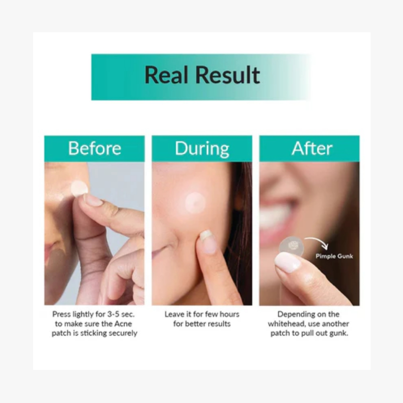 30 Days Miracle Clear Spot Patches