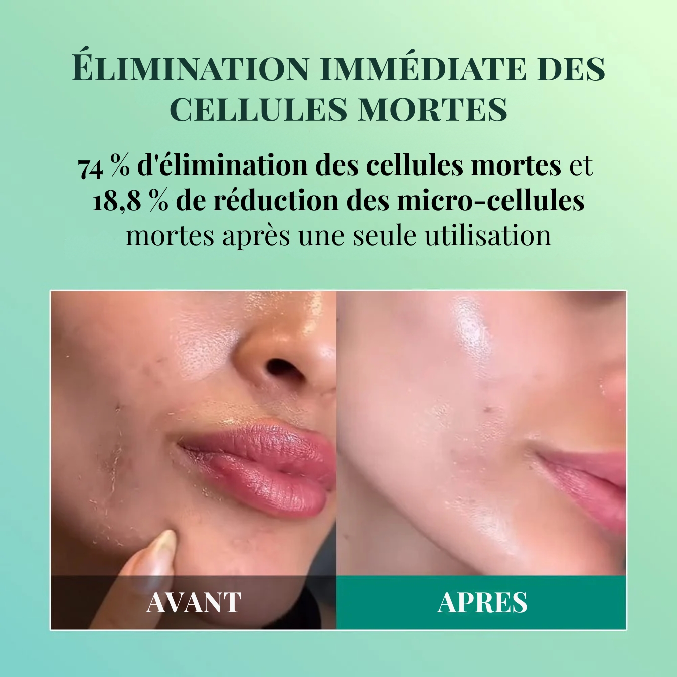 Brightening peeling Gel