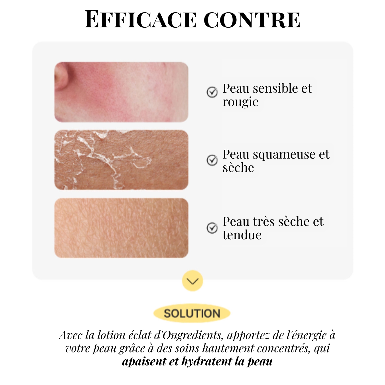 Skin Barrier Calming Lotion