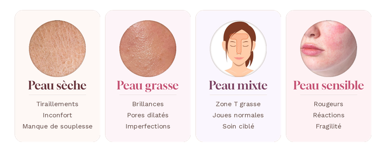 Les 4 types de peau : sèche, grasse, mixte, sensible